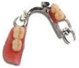 denture - removable 3